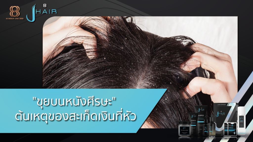 ขุยบนหนังศีรษะ-สเก็ดเงินที่หัว-Jhair serum