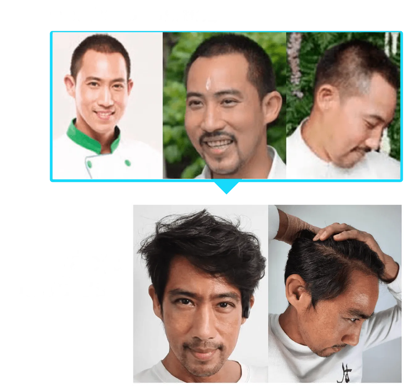J HAIR Serum รีวิว จากคุณตั๊ก นภัสรัญชน์ มิตรธีรโรจน์